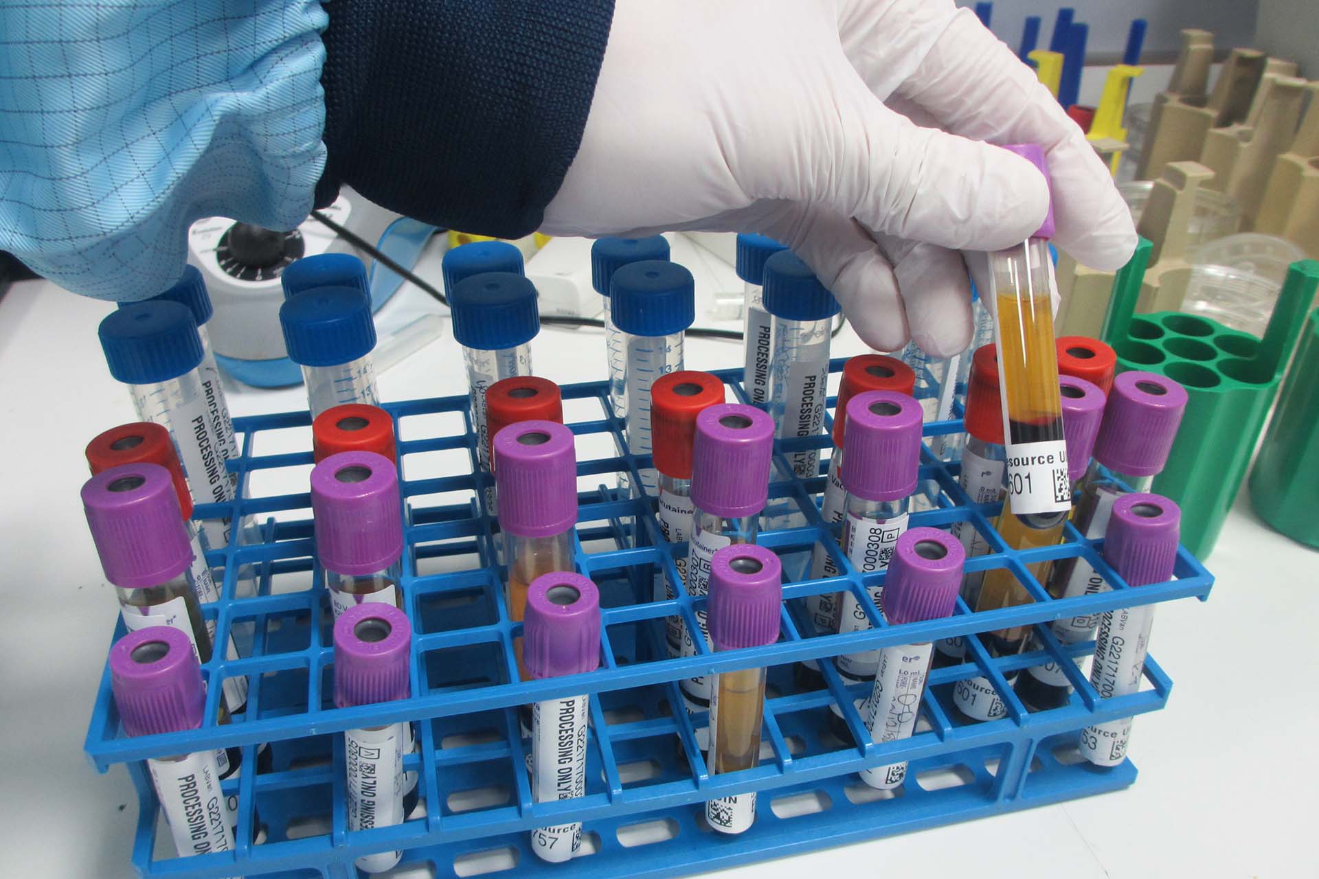 Blood tubes arranged in a rack